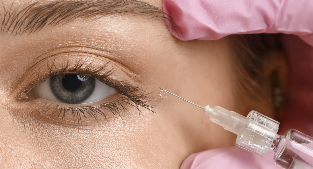 From Botox to RF Microneedling: Trending Non-Surgical Treatments
